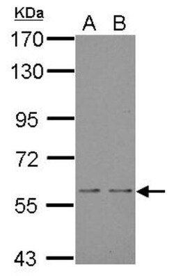 NOX1 Antibody, Novus Biologicals 0.1mg; Unlabeled:Antibodies, Polyclonal