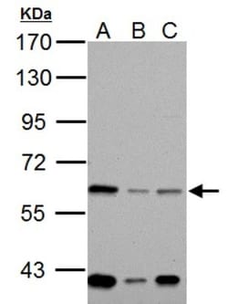 NOX1 Antibody, Novus Biologicals 0.1mg; Unlabeled:Antibodies, Polyclonal