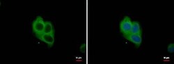 NOX1 Antibody, Novus Biologicals 0.1mg; Unlabeled:Antibodies, Polyclonal