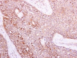 NOX1 Antibody, Novus Biologicals 0.1mg; Unlabeled:Antibodies, Polyclonal