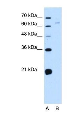 NOX1 Antibody, Novus Biologicals 100 &mu;L | Buy Online | Novus Biologicals | Fisher Scientific