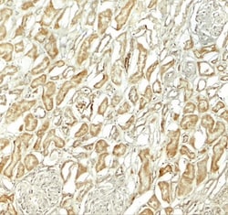 NOX3 Antibody - BSA Free, Novus Biologicals 0.1mg; Unlabeled:Antibodies,