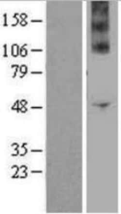 Novus Biologicals&trade;&nbsp;Nox4 Overexpression Lysate