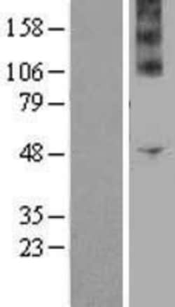 Novus Biologicals Nox4 Overexpression Lysate 0.1 mg | Buy Online | Novus Biologicals&trade; | Fisher Scientific