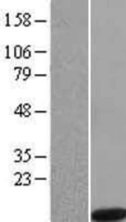 Novus Biologicals™ Noxa Overexpression Lysate