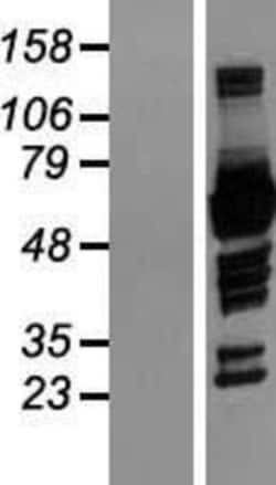 Novus Biologicals p67phox/NOXA2 Overexpression Lysate 0.1mg | Buy Online | Novus Biologicals&trade; | Fisher Scientific