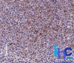 Noxa Antibody (114C307.1) - Non-Recombinant Monoclonal, Novus Biologicals