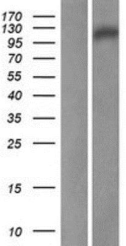 Novus Biologicals&trade;&nbsp;noxin Overexpression Lysate