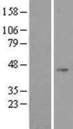 Novus Biologicals&trade;&nbsp;NOXO1 Overexpression Lysate