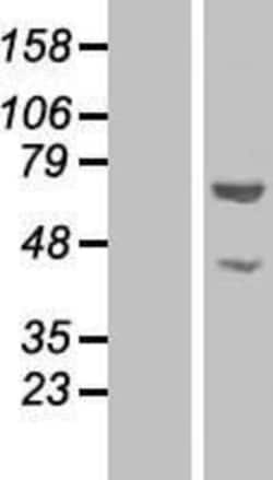 Novus Biologicals&trade;&nbsp;N-PAC Overexpression Lysate