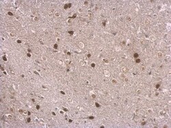 NPAS1 Antibody, Novus Biologicals 0.1mL:Antibodies, Polyclonal