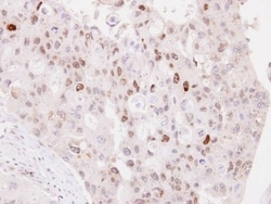 NPAS2 Antibody, Novus Biologicals 0.1mL; Unlabeled:Antibodies, Polyclonal