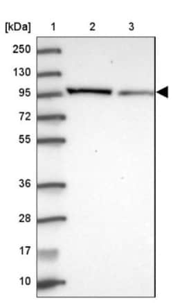 Puromycin-sensitive aminopeptidase/NPEPPS Antibody, Novus Biologicals:Antibodies:Primary