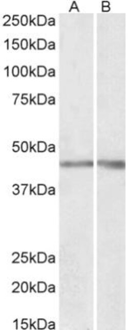 Podocin/NPHS2 Antibody, Novus Biologicals 0.1mg; Unlabeled:Antibodies,