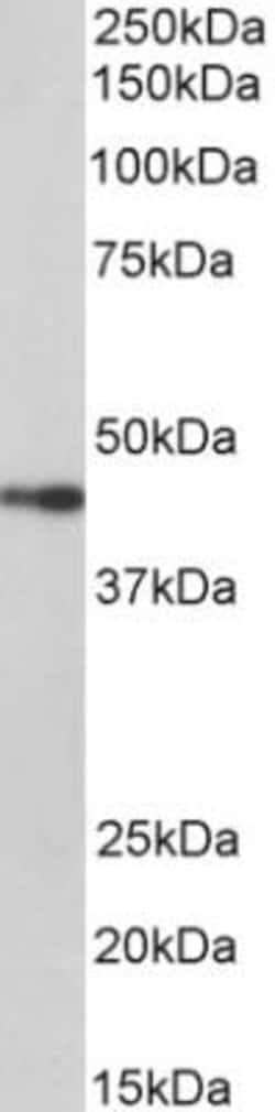 Podocin/NPHS2 Antibody, Novus Biologicals 0.1mg; Unlabeled:Antibodies,