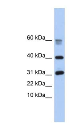 NPIP Antibody, Novus Biologicals:Antibodies:Primary Antibodies