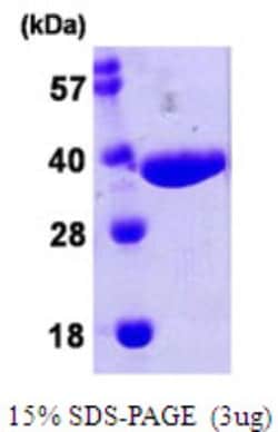 Novus Biologicals&trade;&nbsp;Recombinant E. coli NPL His Protein