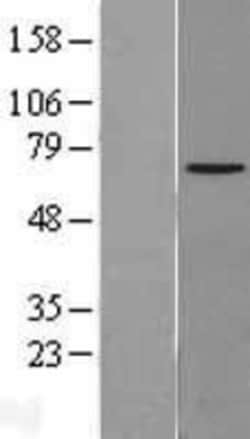 Novus Biologicals™ NPLOC4 Overexpression Lysate