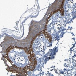 NPRL3 Antibody, Novus Biologicals 0.1mL; Unlabeled:Antibodies, Polyclonal