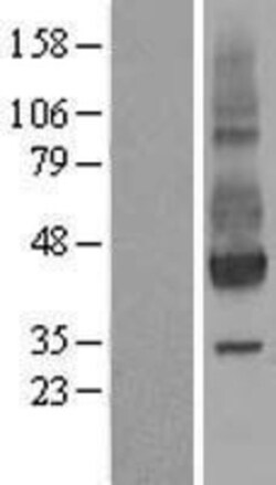 Novus Biologicals™ Neuroplastin Overexpression Lysate