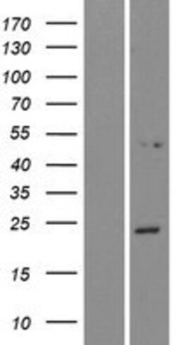 Novus Biologicals&trade;&nbsp;NPVF Overexpression Lysate