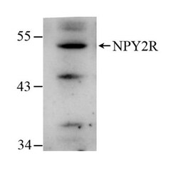 anti-NPY2R, Polyclonal, Novus Biologicals 0.1mL; Unlabeled:Antibodies,