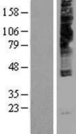 Novus Biologicals&trade;&nbsp;NPY4R Overexpression Lysate