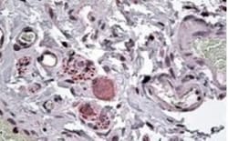 NPY5R Antibody, Novus Biologicals 0.1mg; Unlabeled:Antibodies, Polyclonal