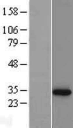 Novus Biologicals™ NQO-1 Overexpression Lysate