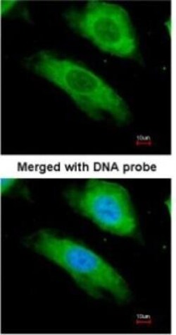 NQO-1 Antibody, Novus Biologicals 0.1mg; Unlabeled:Antibodies, Polyclonal