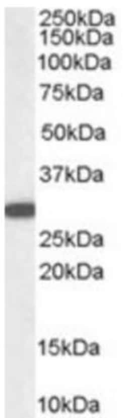 NQO-1 Antibody, Novus Biologicals 0.1 mg | Buy Online | Novus Biologicals | Fisher Scientific