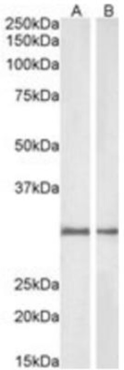 NQO-1 Antibody, Novus Biologicals 0.1 mg | Buy Online | Novus Biologicals | Fisher Scientific