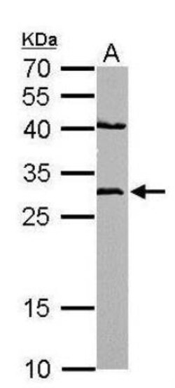 NQO-1 Antibody, Novus Biologicals 0.1mg; Unlabeled:Antibodies, Polyclonal