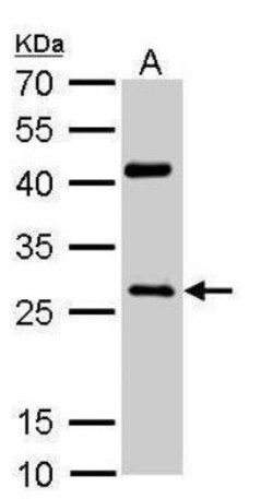 NQO-1 Antibody, Novus Biologicals 0.1mg; Unlabeled:Antibodies, Polyclonal