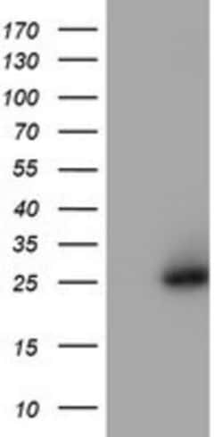 NQO-2 Antibody (OTI3G4), Novus Biologicals 0.1mL; Unlabeled:Antibodies,