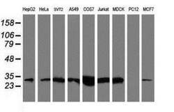 NQO-2 Antibody (OTI3G4), Novus Biologicals 0.1mL; Unlabeled:Antibodies,