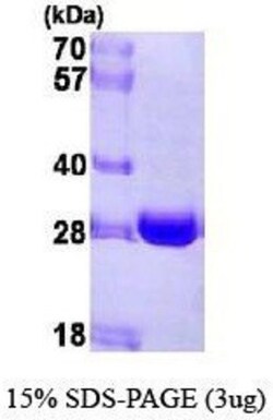 Novus Biologicals&trade;&nbsp;Recombinant Human NQO-2 His Protein