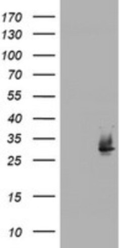 NQO-2 Antibody (OTI3C11), Novus Biologicals 0.1mL; Unlabeled:Antibodies,