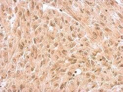 Rev-erb A alpha/NR1D1 Antibody, Novus Biologicals 0.1mL; Unlabeled:Antibodies,