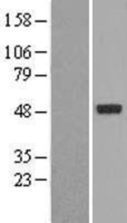 Novus Biologicals&trade;&nbsp;PXR/NR1I2 Overexpression Lysate
