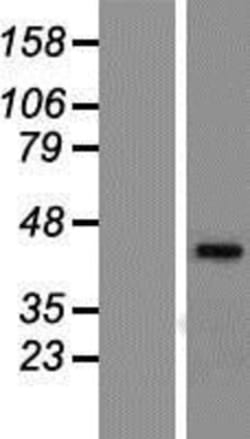 Novus Biologicals&trade;&nbsp;CAR/NR1I3 Overexpression Lysate