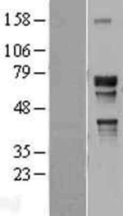 Novus Biologicals&trade;&nbsp;TR4/NR2C2 Overexpression Lysate