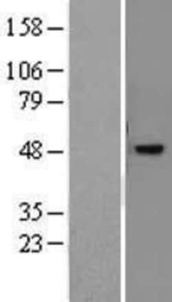 Novus Biologicals&trade;&nbsp;PNR/NR2E3 Overexpression Lysate