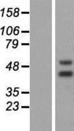 Novus Biologicals&trade;&nbsp;PNR/NR2E3 Overexpression Lysate
