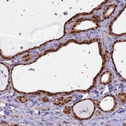 NR4A3/NOR1 Antibody, Novus Biologicals 0.1mL; Unlabeled:Antibodies, Polyclonal