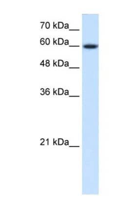 NR4A3/NOR1 Antibody, Novus Biologicals 0.05mg; Unlabeled:Antibodies, Polyclonal