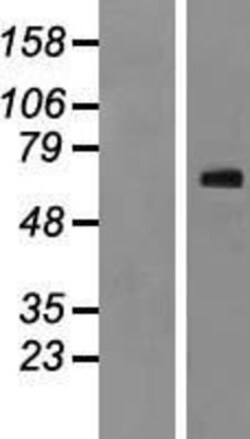 Novus Biologicals&trade;&nbsp;NR4A3/NOR1 Overexpression Lysate