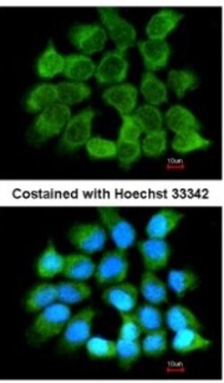 CLC Antibody, Novus Biologicals 0.1mL; Unlabeled:Antibodies, Polyclonal