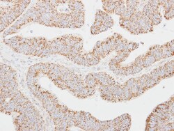CLC Antibody, Novus Biologicals 0.1mL; Unlabeled:Antibodies, Polyclonal