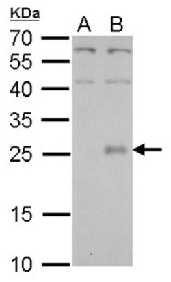 CLC Antibody, Novus Biologicals 0.1mL; Unlabeled:Antibodies, Polyclonal